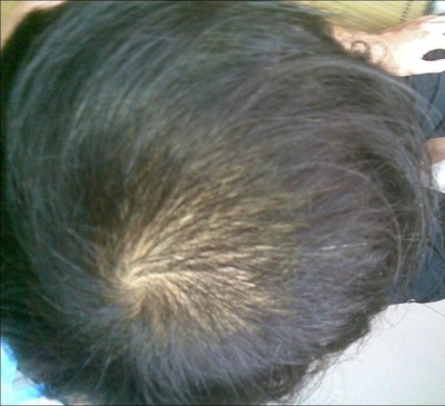 女人如何防脱发 三种食物让你一秋天不掉发